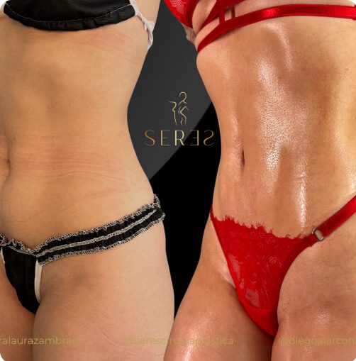 lipogym_1_6