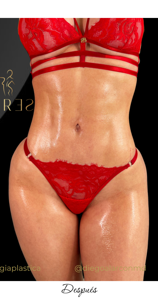 LipoGym_1-10